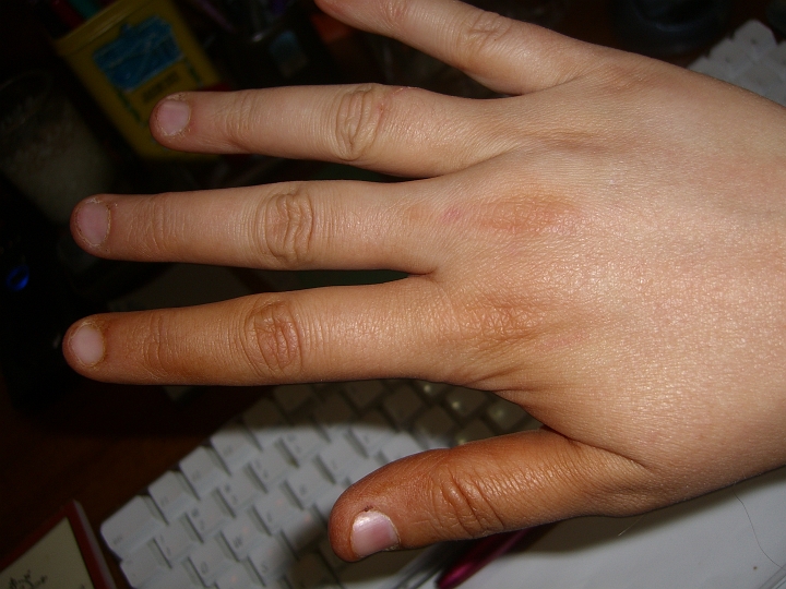 Hands a few hours post-Mystic Tan.JPG